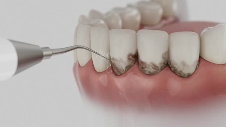 Trusted Teeth Cleaning And Checkup service in Milan, MO - Dentist Open Now